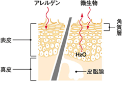 皮膚構造図