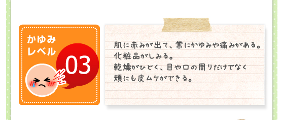 かゆみレベル03／肌に赤みが出て、常にかゆみや痛みがある。化粧品がしみる。乾燥がひどく、目や口の周りだけでなく頬にも皮ムケができる。