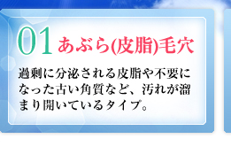 01：あぶら（皮脂）毛穴／過剰に分泌される皮脂や不要になった古い角質など、汚れが溜まり開いているタイプ。