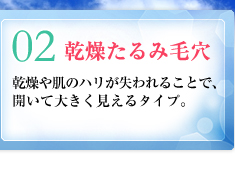 02：乾燥たるみ毛穴／乾燥や肌のハリが失われることで、開いて大きく見えるタイプ。