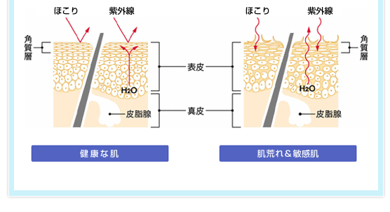 「健康な肌/肌荒れ＆敏感肌」皮膚断面図