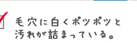 毛穴に白くポツポツと汚れが詰まっている。