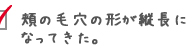 頬の毛穴の形が縦長になってきた。