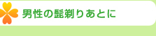 男性の髭剃りあとに