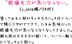 「乾燥毛穴が気にならない」（y_chie様／20代）塗ってみると肌がモッチモチに。4日ぐらいで頬にツヤがでてきて、たるみ気味だった乾燥毛穴が気にならなくなってきました。朝も肌のモチモチが続いて、ついつい触りたくなっちゃう肌に。